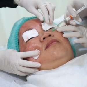 TCA CROSS BOPENG ACNE