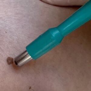PUNCH BIOPSY