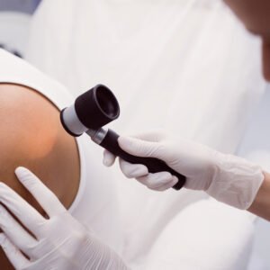 DERMOSCOPE SCREENING KANKER