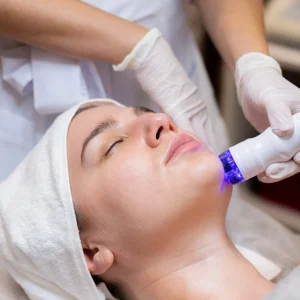 PEELING ACNE