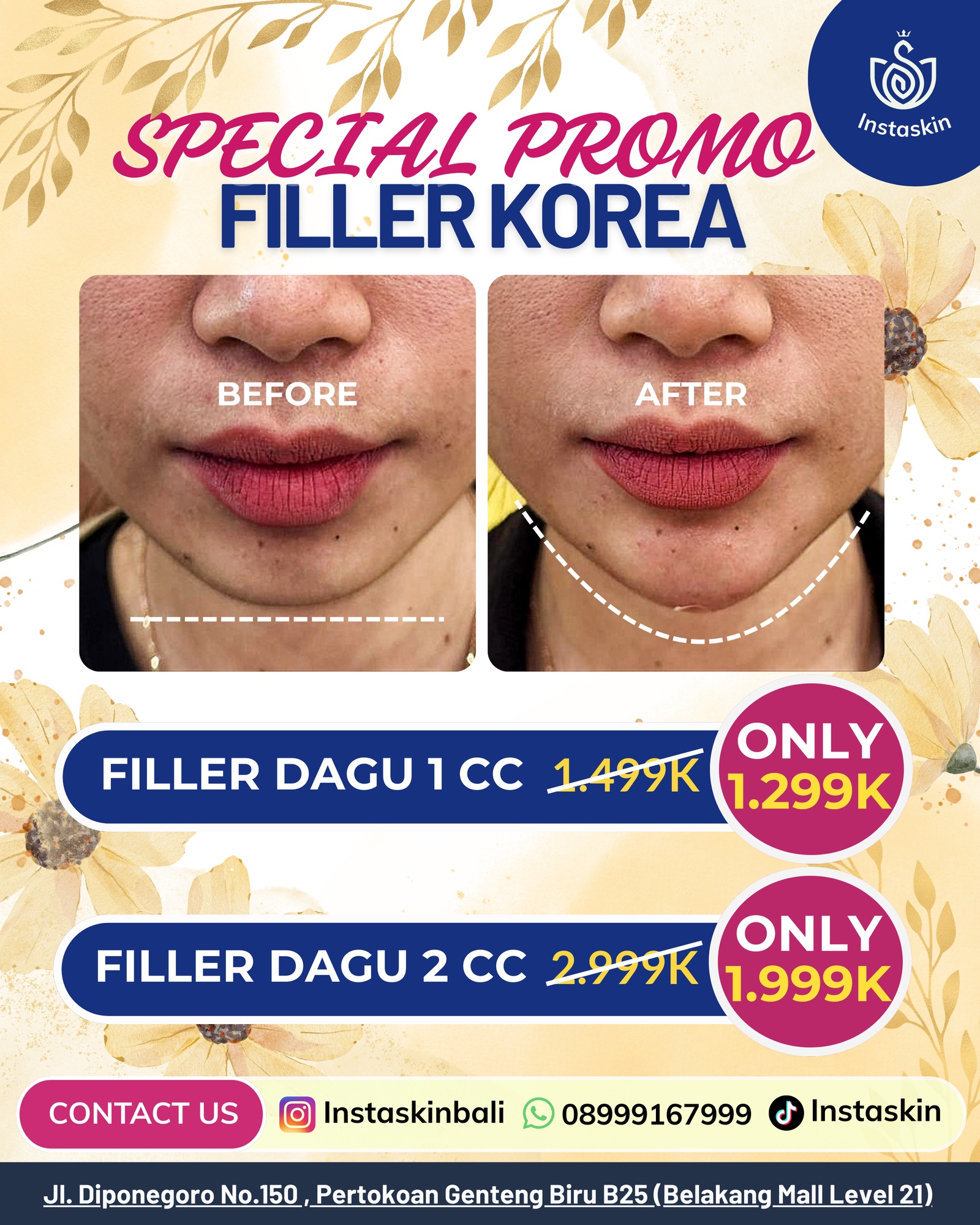 Filler Dagu(2)