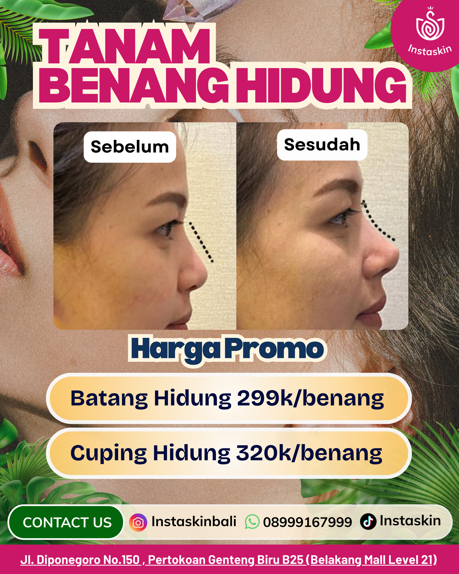 benang hidung fixx